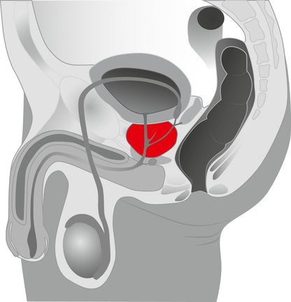 Prostate Massager