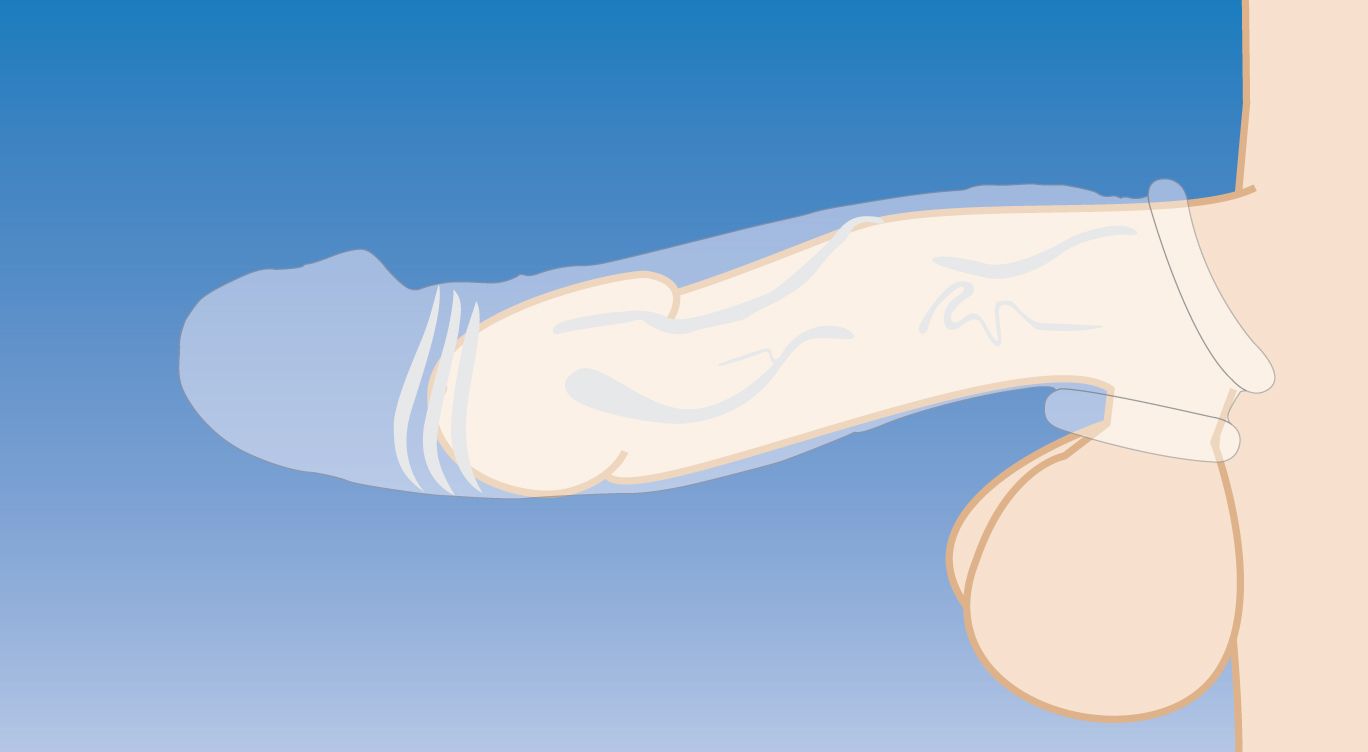 Clear Extender Gebogen Penissleeve